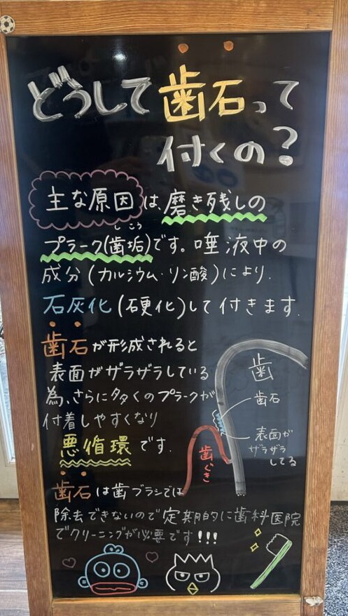 歯石がつく原因とは？放置せずに歯科医院でのクリーニングを受けましょう